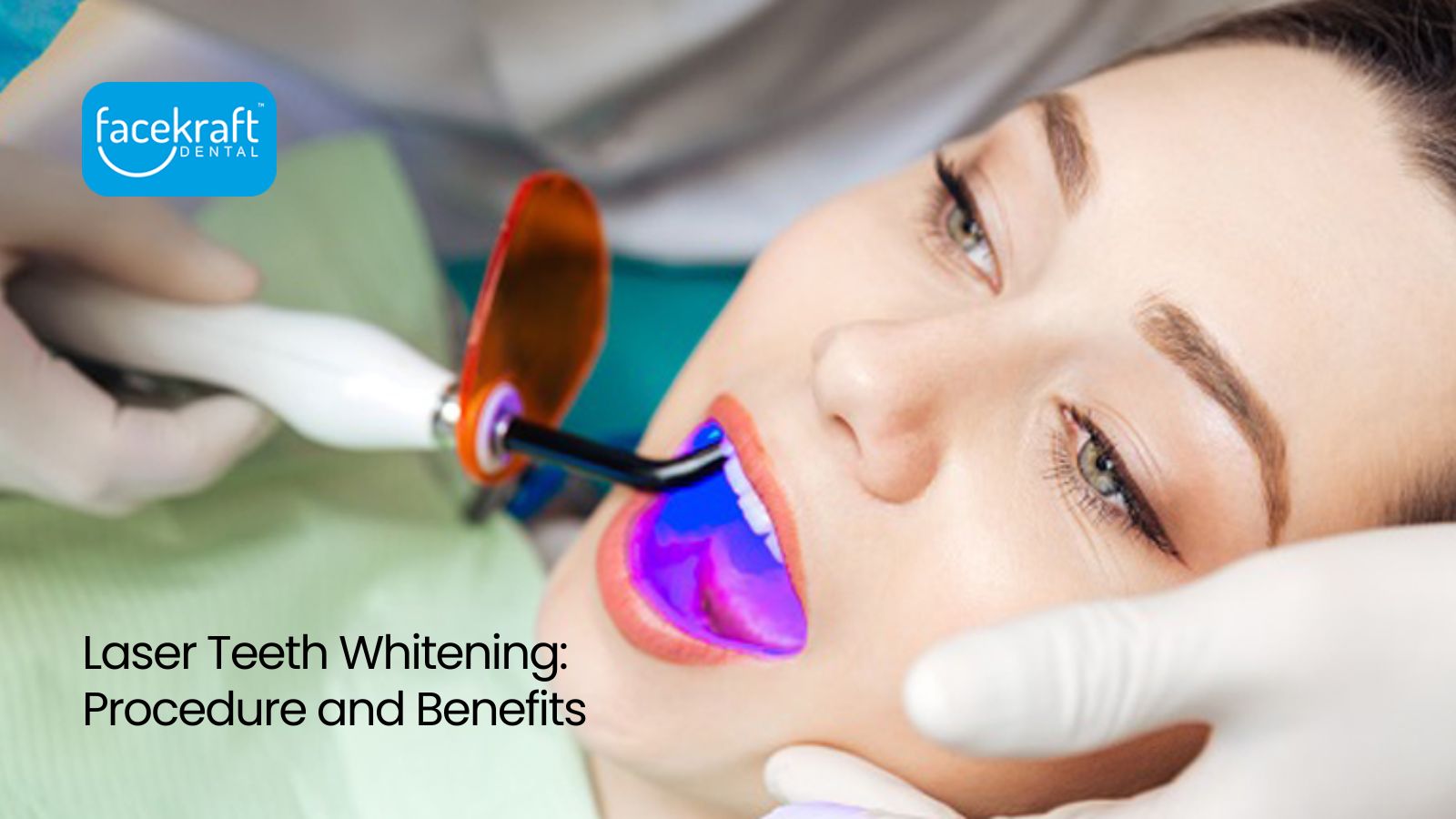 Laser Teeth Whitening: Procedure and Benefits