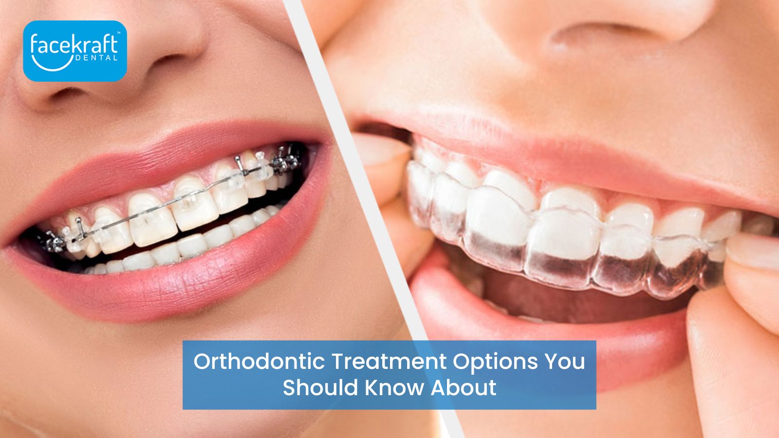 Orthodontic Treatment Options You Should Know About