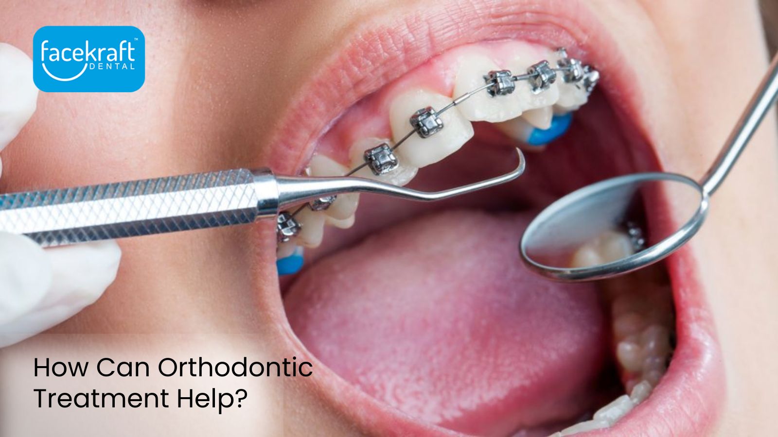 How Can Orthodontic Treatment Help?