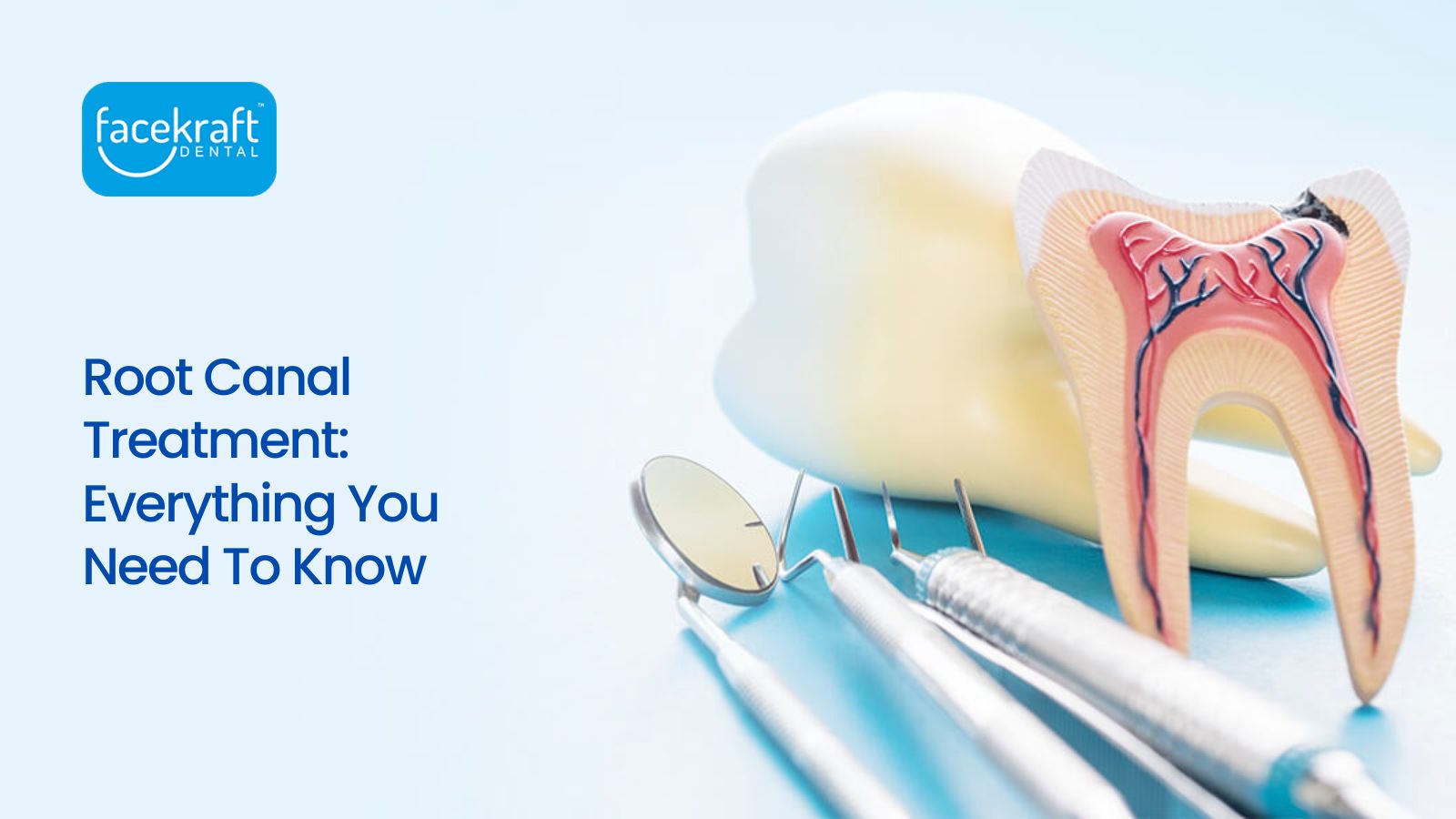 Everything You Need To Know about Root Canal Treatment.