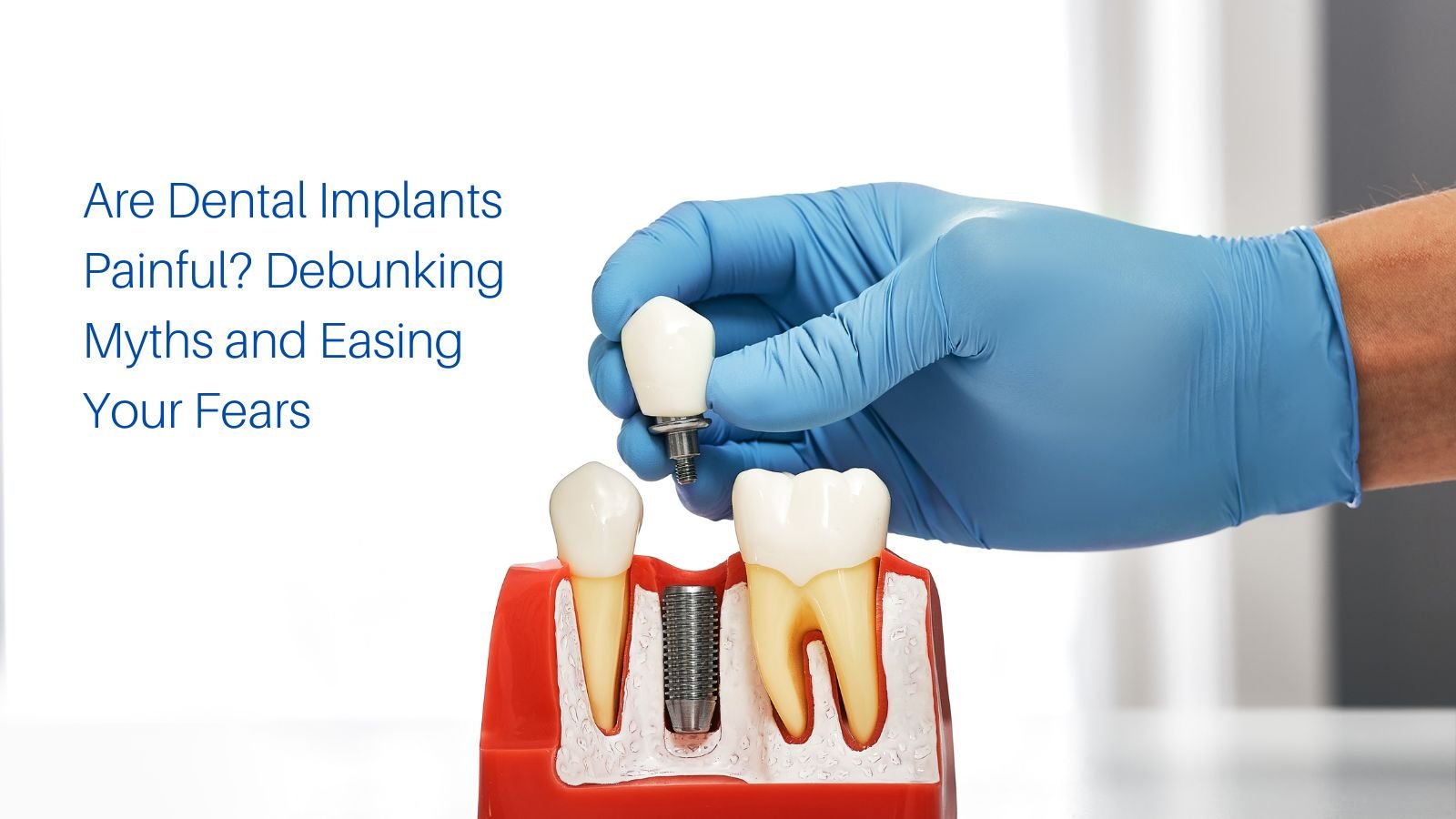 Are Dental Implants Painful? Debunking Myths and Easing Your Fears