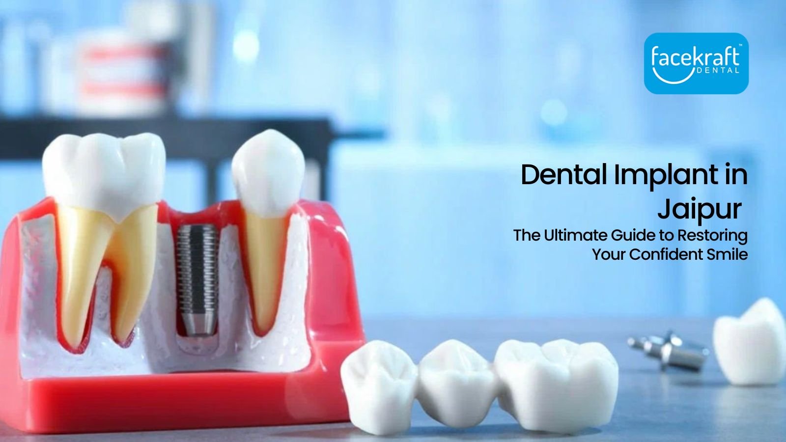 Dental Implants in Jaipur: The Ultimate Guide to Restoring Your Confident Smile